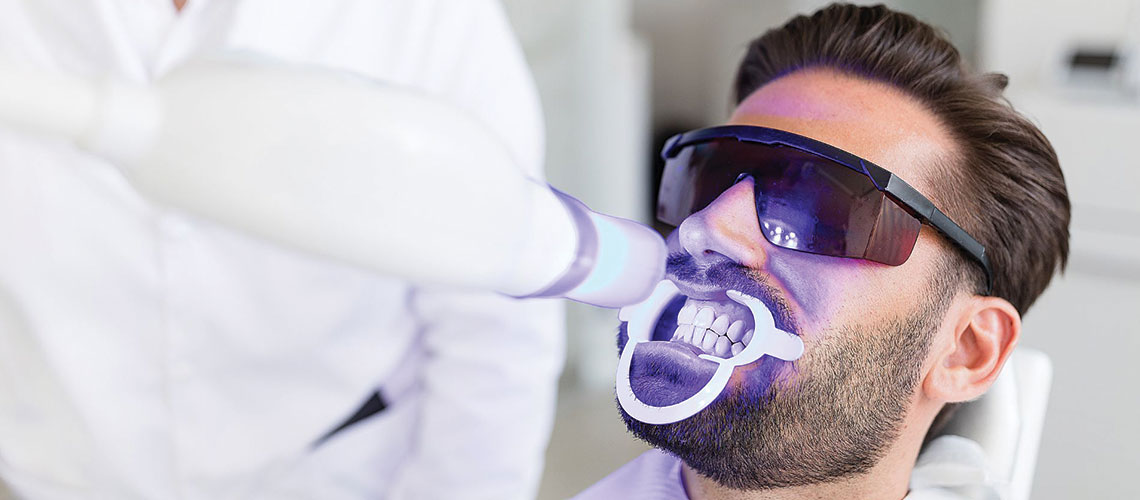 Teeth Whitening in North Miami: Achieve a Radiant Smile with Glo Whitening